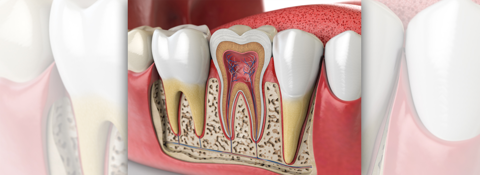 Root Canal Treatment